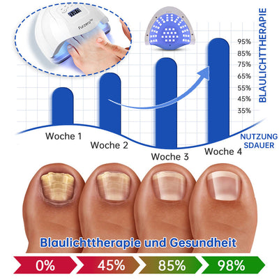 PureNail™ | Lasertherapiegerät gegen Nagelpilz
